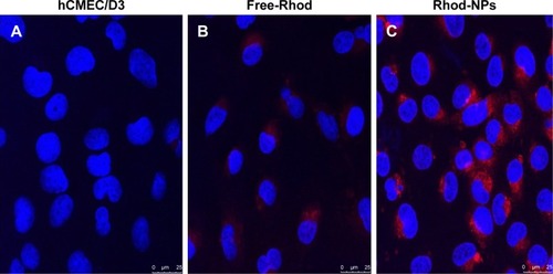 Figure 4 Cellular uptake and intracellular distribution of Rhod-NPs in hCMEC/D3. (A) hCMEC/D3 untreated (control); (B) hCMEC/D3 exposed to Free-Rhod and (C) hCMEC/D3 exposed to Rhod-NPs.Notes: Cells were incubated for 3 hours with 1 µg/mL of NPs. Nuclei were counterstained with DAPI (blue).Abbreviations: Rhod-NPs, Rhod-nanoparticles; hCMEC/D3, human brain microvascular endothelial cell line.