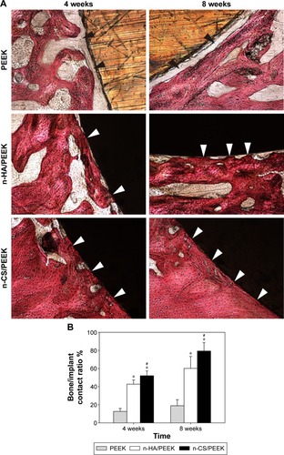 Figure 4 Histological analysis of osseointegration 4 and 8 weeks after implantation.Notes: (A) Histological micrographs. The black arrows indicate fibrous connective tissue, and the white arrows indicate bone contact. (B) Comparison of percentage of bone/implant contact among the three groups. *Represents a significant difference compared with PEEK (P<0.01), and #represents a significant difference compared with n-HA/PEEK (P<0.05).Abbreviations: PEEK, polyetheretherketone; n-HA, nano-hydroxyapatite; n-CS, nano-calcium silicate.