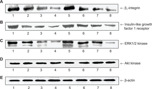 Figure 4 Western immunoblot analysis for β1-integrin (A), insulin-like growth factor I receptor (B), extracellular signal-regulated kinase (ERK1/2) (C), Akt kinase (D), and β-actin (E) in subconfluent human skin fibroblasts (control), cells treated with or without hyaluronic acid for 24 hours.