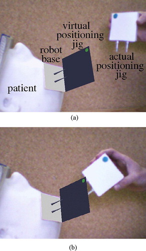 Figure 4. Intraoperative robot positioning augmented reality images. (a) Starting position. (b) Middle position. (c) Final position. [colour version available online.]
