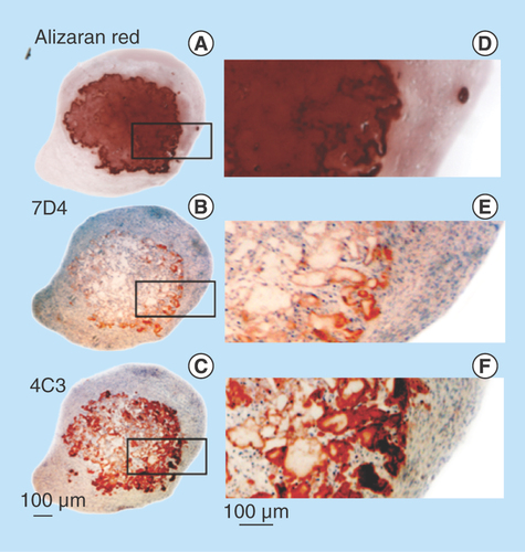 Figure 7.  Demonstration of calcium deposition centrally in an FGF-18 cell pellet using Alizaran Red staining of the pellet section (A). The CS sulphation motifs 7D4 (B) and 4C3 (C) are also depicted localizing to a similar area as the calcium deposition. Segments are serial sections through the same cell pellet. Higher power images of the boxed areas in (A–C) are provided in segments (D–F).