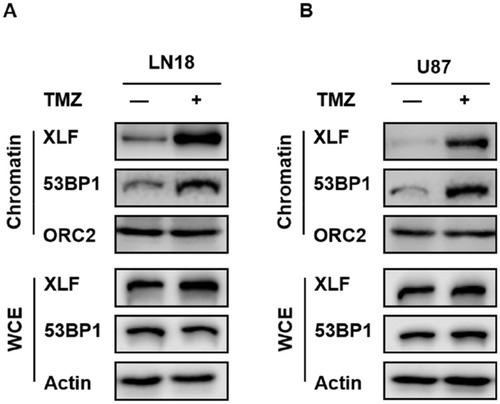 Figure 4 TMZ induces DNA binding activity of XLF and 53BP1 in GBM cells. (A) Chromatin fractionation of XLF and 53BP1 in LN18-WT treated with TMZ. LN18-WT was treated with 5 mM of TMZ for 2 hrs. WCE: whole-cell extract. (B) Chromatin fractionation of XLF and 53BP1 in U87-WT treated with TMZ. U87-WT was treated with 10 mM of TMZ for 2 hrs. WCE: whole-cell extract.