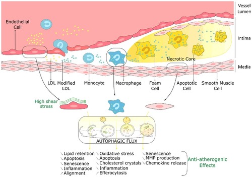 Figure 1. Atheroprotective role of autophagy in endothelial, macrophage and smooth muscle cells. LDL, low-density lipoprotein; MMP, matrix metalloproteinase.