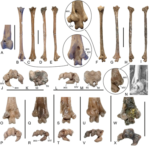 Figure 10. Tibiotarsus and tarsometatarsi of the Zygodactylidae from the early Eocene London Clay of Walton-on-the-Naze (Essex, UK). (A) Primozygodactylus cf. danielsi (NMS.2021.40.47), distal end of left tibiotarsus in cranial view. (B‒E) P. cf. danielsi (NMS.2021.40.47), right tarsometatarsus in (B) plantar, (C) dorsal, (D) lateral, and (E) medial view; the arrow indicates an enlarged detail of the distal end. (F‒I) Primoscens carolinae, sp. nov. (holotype, NMS.2021.40.54), left tarsometatarsus in (F) plantar, (G) dorsal, (H) lateral, and (I) medial view; the arrows indicate enlarged details of the distal end. (J, K) P. cf. danielsi (NMS.2021.40.47), right tarsometatarsus, (J) distal end in distal view and (K) proximal end in proximal view. (L, M) Pr. carolinae, sp. nov. (holotype, NMS.2021.40.54), left tarsometatarsus, (L) distal end in distal view and (M) proximal end in proximal view. (N) Zygodactylus luberonensis from the early Oligocene of France (SMF Av 519), distal end of left tarsometatarsus in lateroplantar view; ultraviolet-induced fluorescence photographs. (O, P) P. cf. danielsi (NMS.2021.40.50), left tarsometatarsus (NMS.2021.40.50) in (O) plantar and (P) distal view. (Q, R) Zygodactylidae, gen. et sp. indet. A (NMS.2021.40.60), left tarsometatarsus (NMS.2021.40.60) in (Q) plantar and (R) distal view. (S, T) Primoscens sp. A (NMS.2021.40.58), right tarsometatarsus (NMS.2021.40.58) in (S) plantar and (T) distal view. (U, V) Primoscens sp. B (NMS.2021.40.59), left tarsometatarsus (NMS.2021.40.59) in (U) plantar and (V) distal view. (W, X) Zygodactylidae, gen. et sp. indet. B (NMS.2021.40.61), left tarsometatarsus (NMS.2021.40.61) in (W) plantar and (X) distal view. Abbreviations: acc, trochlea accessoria; fdl, hypotarsal sulcus/canal for tendon of musculus flexor digitorum longus; fhl, hypotarsal sulcus/canal for tendon of musculus flexor hallucis longus; trIV, trochlea metatarsi IV proper. The scale bars equal 5 mm.