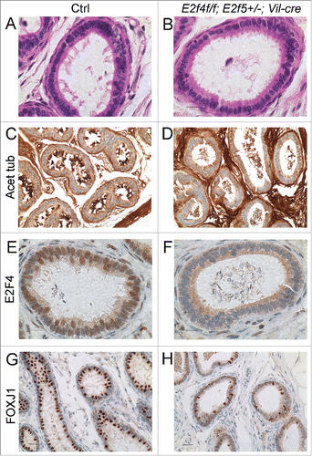 Figure 2. Efferent ducts of adult E2f4f/f;E2f5+/−;Vil-cre mutants lack multiciliated cells. (A) Cilia project into the lumen from the apical surface of multiciliaited cells in controls (Ctrl) but are absent from mutants (B), sections stained with hematoxylin and eosin. (C) Immunohistochemical staining for acetylated tubulin (brown stain) of cilia shows multiciliated cells in controls but not mutants (D). The staining within the lumen of the mutants corresponds to the flagella of spermatozoa. (E) Immunohistochemical staining for E2F4 shows nuclear staining (brown stain) in nuclei of the efferent duct epithelium in the controls but not mutants (F). (G) Immunohistochemical staining for a multiciliated cell expressed transcription factor, FOXJ1 (brown stain) shows nuclear staining in the controls and reduced expression in the mutants (H). Scale bars in C, D, G and H 20 μm; A, B, E and F 10 μm.