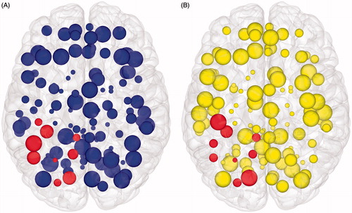Figure 6. Brain mapping with graph theory network measures. Axial view of node features displayed in cortical surface reconstructions. (A) Node size is proportional to clustering co-efficient. (B) Node size is proportional to information centrality. In both figures, those nodes that are spatially adjacent to the tumour are highlighted. Network edges are removed to focus on the node features. If one were to use this information for pre-surgical planning, purposefully sacrificing selected smaller nodes to allow an extended surgical resection could be seen as having a minimal effect on overall network efficiency (and, therefore, by extrapolation on higher cognitive features such as intelligence). However, inadvertently affecting too many of larger nodes would be expected to have a disproportionate effect on overall network efficiency, and, therefore, should be avoided.