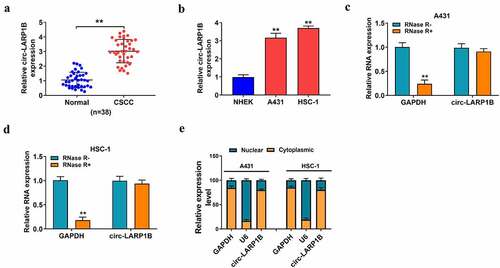 Figure 1. Circ-LARP1B is highly expressed in CSCC tissues and cell lines. (a) The expression of circ-LARP1B was determined in CSCC tissues (n = 38) and adjacent normal tissues (n = 38) by RT-qPCR. (b) The expression of circ-LARP1B in two CSCC cell lines (A431 and HSC-1) and normal human epidermal keratinocytes (NHEK) was measured by RT-qPCR. (c and d) The stability of circ-LARP1B was tested using exonuclease RNase R, and GAPDH was used as the control. The levels of circ-LARP1B and GAPDH were examined in RNase R digestion (RNase R+) group or RNase R- group by RT-qPCR. (e) The subcellular localization of circ-LARP1B was analyzed using the PARISTM Kit Protein and RNA Isolation system. GAPDH or U6 was served as the cytoplasmic or nuclear marker, respectively. **P < 0.01.