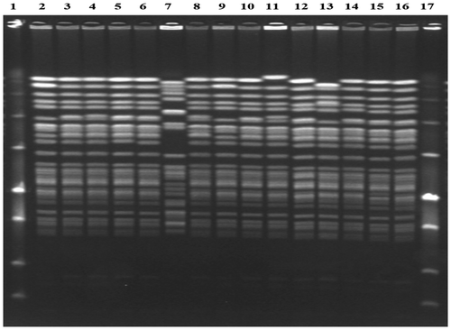 Figure 2: PFGE results of all VRE isolates tested.