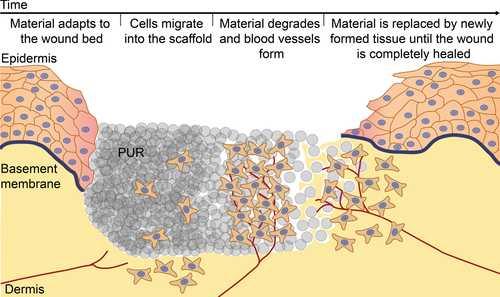 Figure 1. The in vivo tissue engineering based wound treatment concept. The series of events envisioned during wound repair supported by the biodegradable PUR scaffold. Upon wetting, the PUR scaffold adapts to the wound bed, allowing cells to easily migrate into the scaffold. The scaffold is degraded and blood vessels form until the material is completely replaced by newly formed tissue, eventually leading to a healed wound.