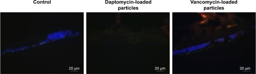 Figure 8 FISH of MRSA biofilms after 24 hours incubation with 20 mg/mL of daptomycin- and vancomycin-loaded PCL microparticles.Notes: Sessile staphylococci were hybridized with pan-bacterial EUB 338FITC and staphylococci-specific STAPHYFITC probes (green) as well as stained with DAPI (blue). Untreated biofilms were used as controls. Magnification: 400×.Abbreviations: FISH, fluorescence in situ hybridization; MRSA, methicillin-resistant Staphylococcus aureus; PCL, poly-epsilon-caprolactone; DAPI, 4′,6-diamidino-2-phenylindole.