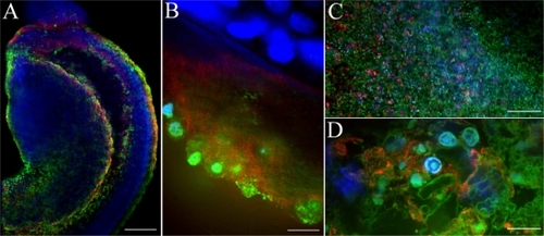 Figure 7 Uptake of HPNPs in the cochlear organotypic culture. The tissues were incubated with 2.5 × 10−6 mol/L (A, B) and 1 × 10−5 mol/L (C, D) HPNPs for 24 hours. A and B are merged images of HPNPs, Myosin VIIA, and DAPI in the modiolus (A) and organ of Corti (B). C) low magnification and D) higher magnification are merged images of HPNPs, F-actin, and DAPI in the lateral wall.Notes: Green: FITC-conjugated HPNPs. Red: Myosin VIIA (A, B), F-actin stained by TRITC-conjugated phalloidin (C, D). Blue: nuclear staining by DAPI. Scale bars: A, C = 103.4 μm, B, D = 10 μm.Abbreviation: HPNPs, hyperbranched polylysine nanoparticles.