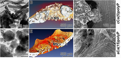 Figure 12 Bone healing with crystalline Ca-phosphate (cCa(5)polyP; containing 5% polyP). (A) Crystalline Ca-phosphate formed during aging in the presence of only 5% polyP. (B and C) Healing studies of encapsulated Ca-phosphate microspheres (MS) in vivo using the rabbit calvarial bone defect model. (B) After 6 weeks of insertion of MS filled with cCa(5)polyP, only a slightly repaired bone defect was seen in animals; (C) the interaction between the microspheres (crystalline phosphate implant) and the adjacent bone is poor. In contrast to the crystalline Ca-phosphate, containing only 5% polyP, (D) addition of 15% polyP to the starting substrates for the preparation of Ca-phosphate, [(NH4)2 HPO4 and CaCl2], freezes the product Ca-phosphate at the amorphous phase. (E) Those MS elicit a strong healing process, the MS fused with adjacent regenerating bone and (F) formed a tight collagen (co) around the MS. Adapted with permission from Acta Biomater. Volume 118, Müller WEG, Ackermann M, Al-Nawas B, etal. Amplified morphogenetic and bone forming activity of amorphous versus crystalline calcium phosphate/polyphosphate. 233–247, copyright 2020, with permission from Elsevier.Citation30