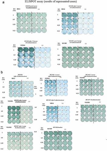 Figure 9. Peripheral blood lymphocytes (PBLs) obtained from each case after each administration of vaccination were cultured in recombinant interleukin 2 (rIL-2) for 14 days with 2 times of each peptide stimulation. The cultured lymphocytes were subjected to the ELISPOT assay after deletion of CD4-poitive cells by magnetic beads. TISI cell were incubated with responder cells in the presence of each peptide or HIV peptide as irrelevant control, and the spot counts were quantified. The cultured lymphocytes were analyzed with HLA-A*2402 or 0201 specific pentamer in the combination with CD8 and CD3 mAbs with flow cytometry. The value of pentamer (+)/CD8 (+) among CD3(+) cells was shown. R/S, responder/stimulator