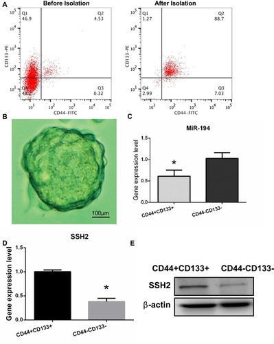 Figure 1 Isolation and identification of colorectal cancer (CRC) stem cells in the SW620 cell line and determination of miR-194 and slingshot 2 (SSH2) expression levels in CRC stem cells and non-stem cells. (A) The proportions of CD44+ and CD133+ cells were analyzed by flow cytometry before and after isolation with microbeads. Before isolation, CD44+/CD133+ cells accounted for 4.53% of the total number of cells. After isolation, CD44+/CD133+ cells accounted for 88.7% of the total number of cells. (B) CRC stem cells were cultured in serum-free medium and sphere formation was evaluated under a microscope after 10 days. Scale bar = 100 µm. (C) RT-qPCR results showed that the expression levels of miR-194 were reduced (*P<0.05 according to the two-tailed t test). (D)The expression levels of SSH2 were increased in CRC stem cells compared with those in CRC non-stem cells (*P<0.05 according to the two-tailed t test). (E) The SSH2 protein expression levels were increased in CRC stem cells compared with those in CRC non-stem cells.
