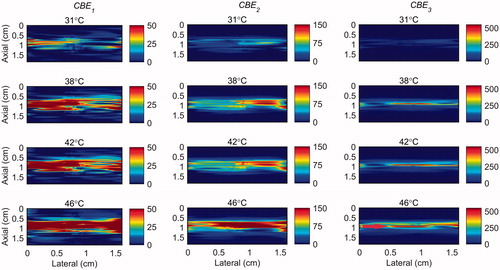 Figure 5. 2 D maps of CBE1 (left), CBE2 (middle), and CBE3 (right) in tissue mimicking gel phantom while the temperature was elevated from 26 to 46 °C with the presence of vibration in the phantom. The temperatures measured by the inserted thermocouple were 31, 38, 42 and 46 °C at the center of heated region. The color bars represent percentage change in backscattered energy. The heated region is along the arrow in the lower right panel.