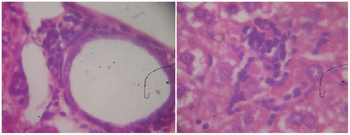 Figure 3b. Section of mouse liver treated with 120 mg/kg of G. lucidium total extract showing a mild active hepatitis with no inflammatory at central vein and slight portal inflammation. (Hematoxylin and eosin-stained paraffin section; H&E 400).