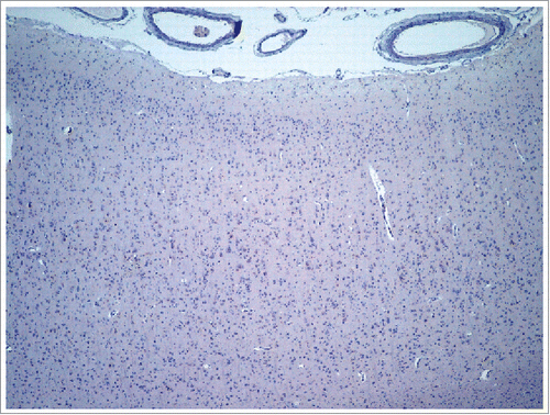 FIGURE 3. Frontal cortex showing no deposition of β-amyloid.