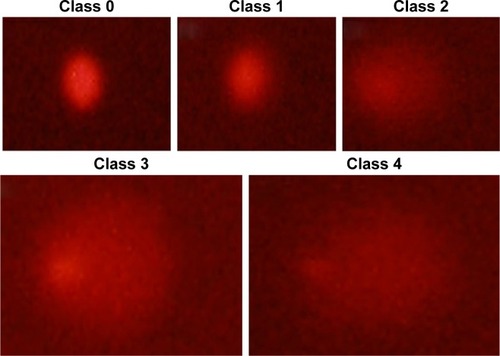 Figure 1 DNA damage in human lymphocytes assessed with alkaline comet assay.