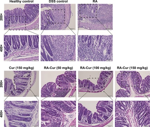 Figure 8 Histopathologic examinations of colon tissues.Notes: Representative colon sections from the healthy control group, DSS control group, RA-treated group, Cur 150 mg/kg-treated group, RA-Cur 50 mg/kg-treated group, RA-Cur 100 mg/kg-treated group, and RA-Cur 150 mg/kg-treated group. Scale bar to 200× =100 µm. Scale bar to 400× =50 µm.Abbreviations: Cur, curcumin; DSS, dextran sodium sulfate; RA, rebaudioside A; RA-Cur, RA-based self-nanomicellizing solid dispersion containing Cur.