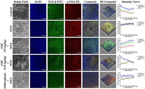 Figure 6 Immunofluorescence images showing the expression of TGF-β and α-SMA. DAPI was used for nuclear staining. Slides were viewed using a confocal microscope (Magnification 20×)(Scale bar: 100 μm). Respective fluorescence intensities (TGF-β-FITC, α-SMA-PE, and DAPI) were analyzed using ImageJ software through RGB calculator.