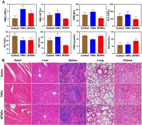 Figure 10 In vivo biocompatibility evaluation. (A) In vivo complete blood count and biochemical detection 3 h after injection of the indicated treatment groups. (B) H&E staining of major organs (heart, liver, spleen, lung and kidney) 24 h after injection of the indicated treatments (scale bar: 100 μm).