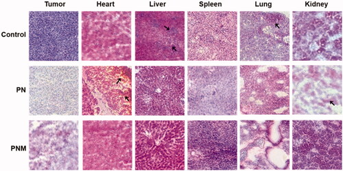 Figure 8. H&E staining of tissue sections (40×) from different treatment groups, black arrows pointed at obvious morphological changes. The lesions in liver and metastases in lung from control group were relieved once received PN and PNM treatment. Moreover, cardiac and renal toxicities of PTX were significantly alleviated in PNM treated group compared to PN.