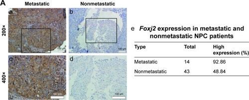 Figure 5 Knockdown of Foxj2 decreases the migration of CNE-2 cells.