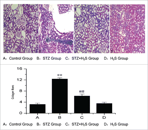 Figure 1. Pathological changes in diabetic rats in each group. (A: Control Group, B: STZ Group, C : STZ+H2S Group, D : H2S Group).