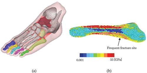 Figure 2. Finite-element foot model: (a) 3D bone and ligament structure of the foot model (b) Young’s modulus distribution of the fifth metatarsal model.