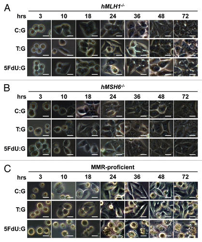 Figure 2 5FdU-containing heteroduplex plasmid leads to cellular morphological changes in MMR-proficient cells. Twelve hours after transfection, hMLH1-/- (A), hMSH6-/- (B) and MMR-proficient (C) cells were seeded at a density of 1.5 × 105 cells per well onto 6-well plates and observed by microscope. By 24 h after seeding, the 5FdU plasmid induced morphological changes consistent with cell death in the MMR-proficient cells (C), while no morphological changes were observed in the hMLH1-/- (A) and hMSH6-/- (B) cells. Neither MMR-proficient cells nor MMR-deficient cells demonstrated morphological changes by heteroduplex (T:G) and negative (C:G) control plasmids. Scale bars; 10 µm. 5FdU:G; 5FdU containing heteroduplex plasmid, T:G; positive control heteroduplex plasmid, C:G; unaltered plasmid (negative control).