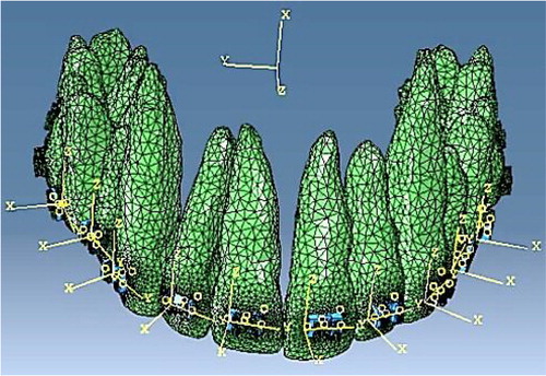 Figure 1. 3D FE model of a full maxillary arch upon insertion of the first archwire within the brackets.