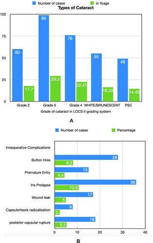 Figure 3 (A) Bar chart showing different grades of nuclear cataract operated. (B) Bar chart demonstrating various adverse events during interoperated period experienced by resident surgeon.