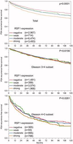 Figure 2. Association between RSF1 expression and PSA recurrence in the total cohort and the Gleason 3 + 4 and 4 + 3 subset.