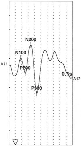 Figure 1. A prototypical ERP trace.