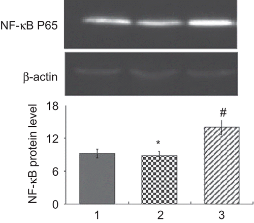 Figure 3.  Naringin decreased the expression of nuclear factor kappa B (NF-κB) p65 in nuclear extracts of HaCaT cells in western blot. 1, Untreated HaCaT cells, 2, cells treated with 0.5 mmol/L naringin, 3, cells stimulated with tumor necrosis factor alpha (TNF-α)/interferon gamma (IFN-γ). #Compared with untreated cells, P < 0.02. *Compared with cells stimulated with TNF-α/IFN-γ, P < 0.01.