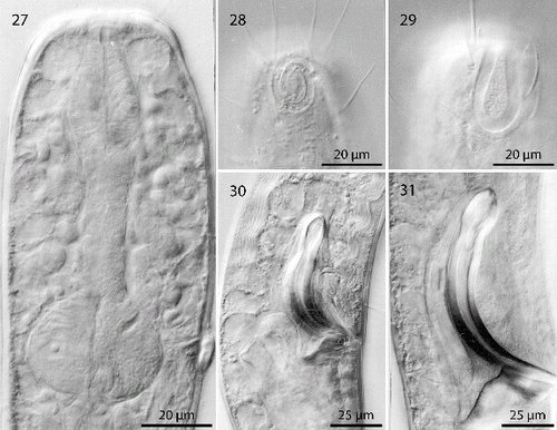 Figs. 27–31. Robbea hypermnestra sp. nov. 27. Pharyngeal region, optical section; 28. Female, amphidial fovea; 29. Male, amphidial fovea; 30. Female, spiculum; 31. Male, spiculum. LM Interference contrast.