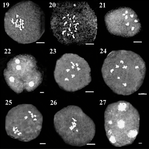 Figures 19–27 Representative meiotic cells in different species of O. sect. Hymenobrychis: 19, 20. diakinesis and desynapsis in Qotur population of O. michauxii; 21, 22. diakinesis and unreduced gamete in Ardebil population of O. michauxii; 23. diakinesis in O. sintenisii; 24–27. diakinesis, laggard, B-chromosome and micronucleus in O. oshnaviyehensis. Scale bar: 3 μm.