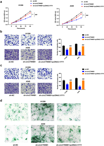 Figure 5. YY1 overexpression can rescue the decreased cell proliferation, migration, invasion, and the increased cell senescence mediated by circCTNNB1 suppression.