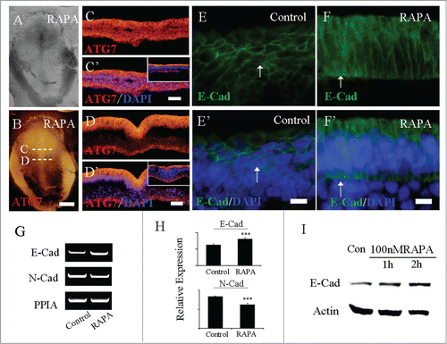 Figure 4. RAPA treatment promoted the expression of ATG7 and E-Cadherin. Immunofluorescent staining against Atg7 and E-Cadherin were performed on the control and RAPA-treated HH4 chick embryos. A-B: The bright-filed images (A) and Atg7 immunofluorescent images (B) of the embryo respectively treated by RAPA at 33 hour. C-C′: The transverse sections of Atg7 expression (C) and Atg7 expression + DAPI staining (C′) respectively at the level indicated by dotted line C in B panel, the small panel in C′ is control section. D-D′: The transverse sections of Atg7 expression (D) and Atg7 expression + DAPI staining (D′) respectively at the level indicated by dotted line D in B panel, the small panel in D′ is control section. E-E′: E-Cadherin is expressed on the ectoderm cell membrane of control embryo (white arrow in E′); F-F′: E-Cadherin expression level was enhanced on ectoderm cell membrane and ectopic expression in nucleus after RAPA treatment (white arrow in F′). I: Primitive streaks were collected for RT-PCR analysis after being treated with RAPA for 33 h and the control group. In RAPA-treated embryos, E-Cad expression was increased and N-Cad expression was inhibited in comparison with control embryos (N = 20). H: E-Cadherin and N-Cadherin expression levels were detected by real-time PCR. E-Cadherin expression was enhanced and N-Cadherin expression was inhibited in 80 nM RAPA-treated embryos compared to the control. Error bars indicate mean ± s.d. ***P < 0.001 indicating highly significant difference between RAPA-treated and control embryos. I: Western blot shows that the expression of E-Cadherin in HCT116 cells from no RAPA treatment (control), or 100 nM RAPA treatment for 1 hour and 2 hours. Actin was used as a loading control. Scale bars = 600 μm in A-B and 500 μm in C-C′ and 500 μm in D-D′, E-E′.