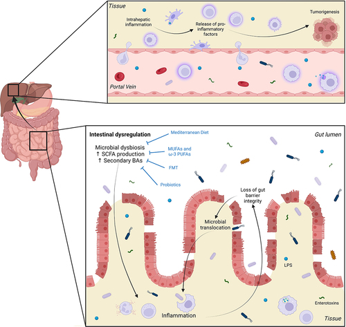 Figure 1. Events leading to initiation of inflammatory response in the gut and tumorigenesis in the liver. Intestinal dysregulation, characterized by disruption of normal gut flora balance and reduced microbial diversity (microbial dysbiosis), is associated with increased production of short chain fatty acids (SCFAs) and secondary bile acids (BAs). These factors can contribute to intestinal inflammation and the subsequent loss of gut barrier integrity through damage to epithelial tight junctions and the brush border. This, in turn, allows the translocation of bacteria and bacterial ligands such as lipopolysaccharide (LPS) and other enterotoxins, into the circulation. From here, these components can travel through the portal circulation to reach the liver where they catalyze chronic inflammation. The secretion of pro-inflammatory cytokines, chemokines, growth factors, prostaglandins and pro-angiogenic factors establishes an environment that is favorable to tumorigenesis. Interventions such as consumption of the Mediterranean diet and monounsaturated and omega-3 polyunsaturated fatty acids (MUFAs and PUFAs), as well as fecal microbiota transplantation (FMT) and probiotics have been linked to reduced HCC incidence due to their capacity to improve dysbiosis. Figure created with BioRender.com.