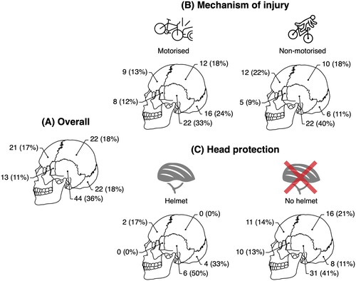Figure 4. Skull fractures by mechanism of injury and helmet use. (A) Overall patterns; (B) Mechanism of injury; (c) Helmet use.