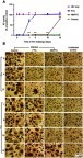 Figure 4 NMFTC antiretroviral activity. (A) HIV-1 RT activity in FTC and NMFTC pre-exposed MDMs showing complete inhibition with NMFTC for up to 10 days as compared with FTC that did not have effect beyond day 1 (mean±SD, n=9; ***P≤0.001). (B) HIV-1 p24 antigen staining showing results similar to RT assay demonstrated by the absence of p24 staining (brown color) for up to 10 days after NMFTC pre-exposure whereas FTC had no effect by day 1.Abbreviations: RT, reverse transcriptase; FTC, emtricitabine; NMFTC, nanoparticle of modified FTC prodrug; MDM, monocyte-derived macrophage.