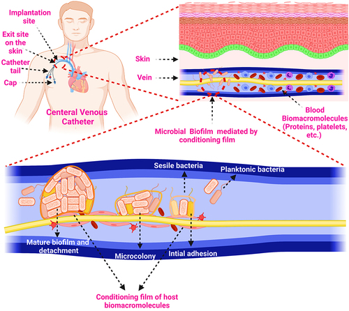 Figure 4 Biofilm formation on the biomedical device (catheter) mediated by conditioning film.