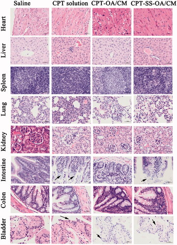 Figure 9. Histological section of vital organs (heart, liver, spleen, lung, kidneys, intestine, colon and bladder) stained with hematoxylin and eosin after intravenous treatment; autolytic changes in the intestine and epithelium loss in the bladder were marked with blank arrows.