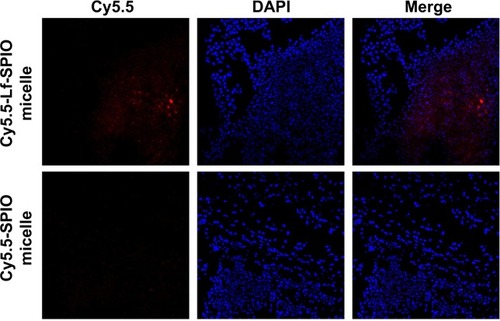 Figure 8 The confocal fluorescence images of the brain slices.Notes: Upper row, sections of the group with treatment of Cy5.5-Lf-SPIO micelles (100×); lower row, sections of the group with treatment of Cy5.5-SPIO micelles (100×).Abbreviations: Lf, lactoferrin; SPIO, superparamagnetic iron oxide; DAPI, 4′,6-diamidino-2-phenylindole.