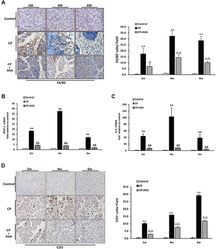 Figure 4 Aspirin attenuates inflammatory infiltration in the pancreas of mice treated with 20% L-arginine. (A) IHC staining for F4/80 in pancreas (original magnification: 200×) and F4/80 positive cell count analysis. (B) MCP-1 and (C) IL-6 mRNA expression was analyzed by RT-PCR, fold changes were normalized to β-actin mRNA. Results were expressed as Mean±SD (each group, n=6). **P<0.01 vs control group; ΔP<0.05, ΔΔP<0.01vs. CP group. (D) IHC staining for CD3 in pancreas (original magnification: 200×) and CD3 positive cell count analysis.