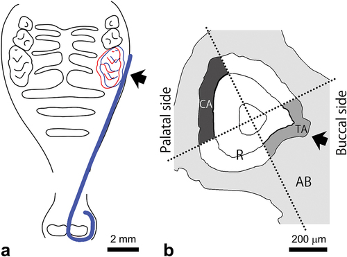 Figure 1. Schematic drawings at 0 days (blue in a, b) and 14 days (red in a) after experimental tooth movement of the first molar tooth. A nickel-titanium wire with 0.012-inch diameter moves the first molar tooth to the palatal side (a). Panel b shows the cross section of the palatal root (R) in the first molar tooth with experimental tooth movement. The closed arrow indicates the direction of the force by the nickel-titanium wire. Buccal and palatal regions in the periodontal ligament (PDL) were analysed as tension (TA) and compression areas (CA), respectively. AB; alveolar bone.