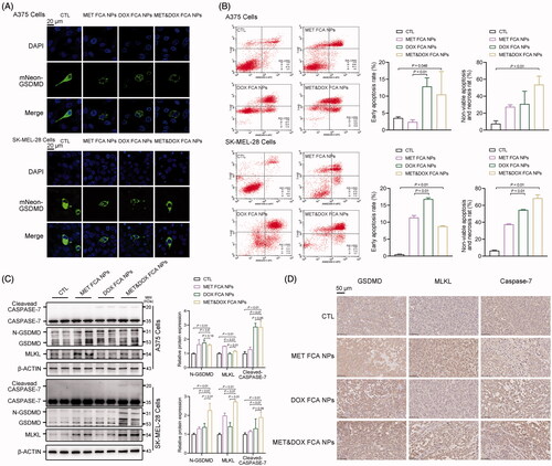 Figure 6. FCA NP-loaded MET&DOX induces melanoma cell death via induction of pyroptosis, apoptosis, and necroptosis (PANoptosis). (A) Representative confocal microscopy images of cleaving mNeon-GSDMD expressed in human A375 and SK-MEI-28 cells, scale bars: 20 μm. (B) Apoptosis and necroptosis of human A375 and SK-MEL-28 cells following 24-h incubation with different formulations; n = 3 for each group. (C) The protein expression levels of the GSDMD, CASPASE-7, and MLKL protein in human A375 and SK-MEL-28 cells following 24 h incubation with different formulations; n = 4 for each group. (D) IHC analysis of the GSDMD, Caspase-7, and MLKL protein expression in the corresponding tumor tissues obtained after the different treatments; scale bars: 50 μm, n = 5 for each group. CTL: FCA NPs, MET FCA NPs: FCA NP-loaded MET, DOX FCA NPs: FCA NP-loaded DOX, MET&DOX FCA NPs: FCA NP-loaded MET&DOX.