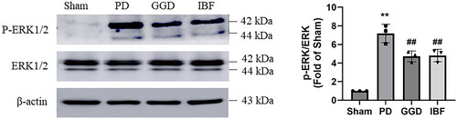 Figure 4. Effect of GGD on the activation of ERK1/2 signalling. The protein levels of phosphorylated ERK1/2 and total ERK1/2 in the uterine tissue of each group were measured with western blotting. Data are presented as mean ± SD (n = 3). **, p < 0.01 vs. Sham group, ##, p < 0.01 vs. GGD group (Tukey–Kramer’s test). PD: Primary dysmenorrhoea; GGD: Ge-Gen decoction; IBF: Ibuprofen.