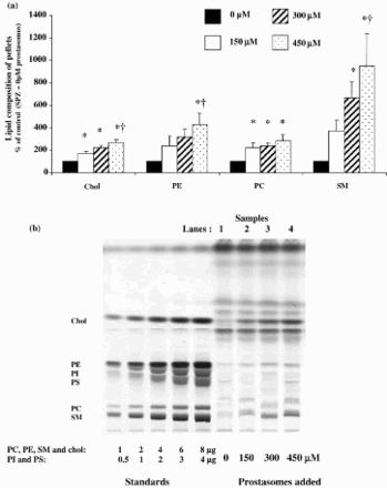 Figure 4.  Pellets lipid composition after incubation of spermatozoa with increasing concentrations of prostasomes. Incubation of spermatozoa with increasing concentrations of prostasomes resulted in a significant enrichment of the pellets in Chol, PE, PC and SM (Fig. 4a). The values are means ± SEM, n = 7 (for Chol, PE and SM) and n = 4 (for PC). * significantly different (p < 0.05) compared with control (SPZ + 0 μM prostasomes), † significantly different (p < 0.05) compared with 150 μM. A picture of the resulting HPTLC plate of the analysis of lipids extracted from spermatozoa alone (control; SPZ + 0 μM prostasomes, lane 1) or spermatozoa incubated with different concentrations of prostasomes (150, 300, 450 μM, lanes 2-3-4 respectively) is shown (Fig. 4b). The amounts of standards spotted on the plate are for PC, PE, SM and Chol: 1, 2, 4, 6 and 8 μg and for PI and PS: 0.5, 1, 2, 3, 4 μg.